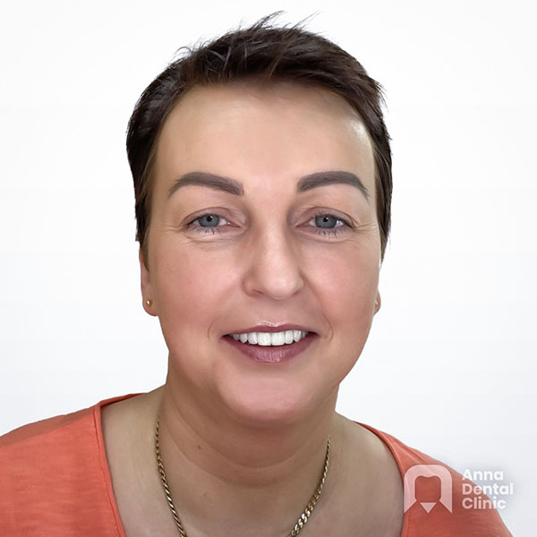 Metamorfoza uśmiechu | Anna