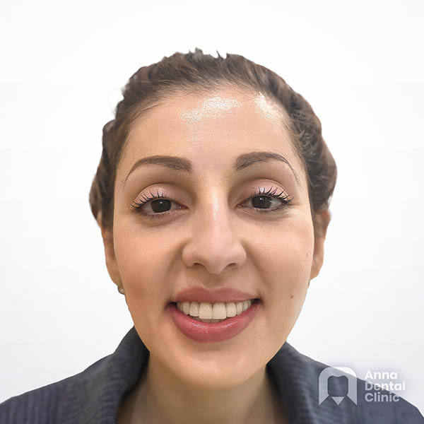 Metamorfoza uśmiechu | Emila