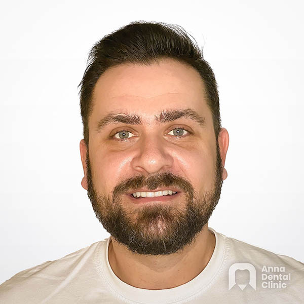 Metamorfoza uśmiechu | Krzysztof