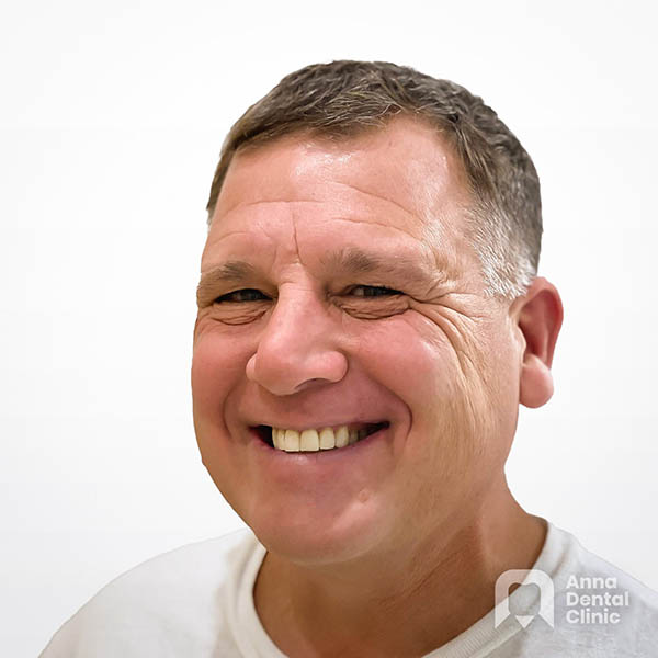 Metamorfoza uśmiechu | James