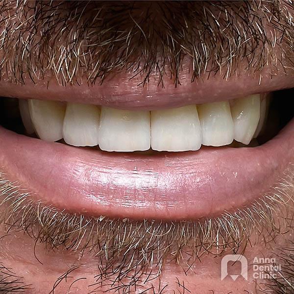 Metamorfoza uśmiechu | Ryszard