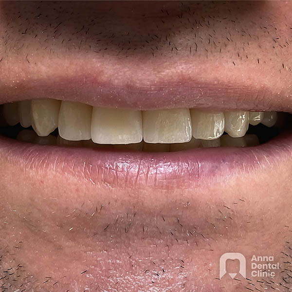 Metamorfoza uśmiechu | Adrian