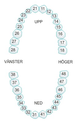 Modell av den övre och undre tandbågen